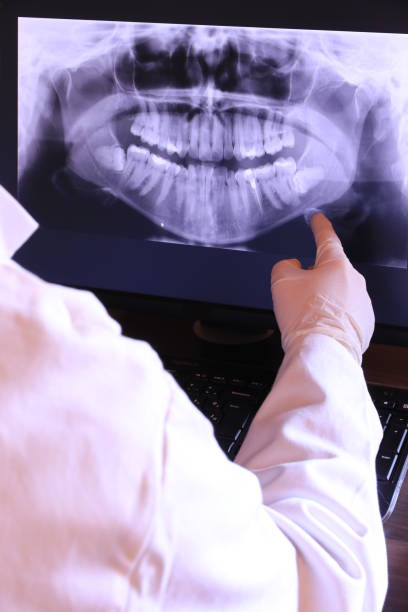 Best Emergency Root Canal Treatment in Winfield, IA