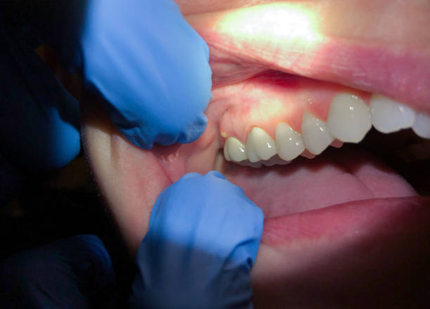Best Holiday Emergency Dentist in Winfield, IA